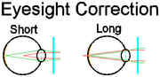 Illustration of how the two types of glasses work -- note how glasses for near sight diverge the rays